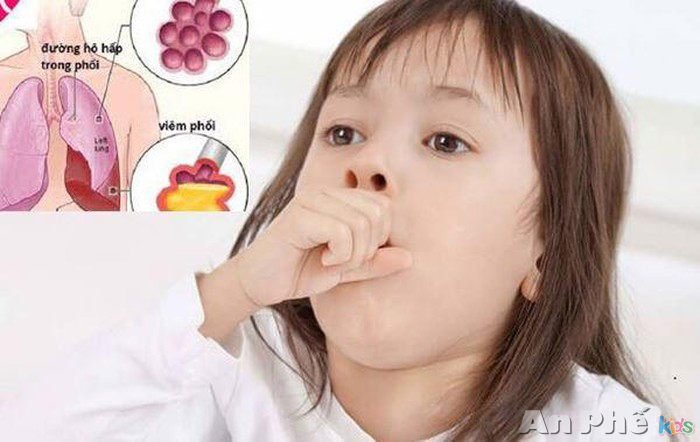 Đặc điểm cơn ho ở trẻ bị viêm phế quản - trẻ ho do viêm phổi